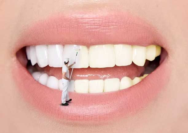 GebzeDiş Beyazlatma